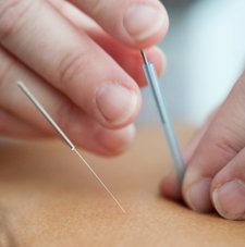 Akupunktur barnmorska Halland Skåne Småland